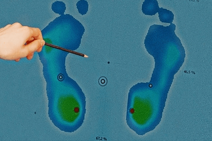 estudio-biomecanico-pisada-malaga